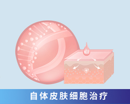 自體皮膚細胞治療